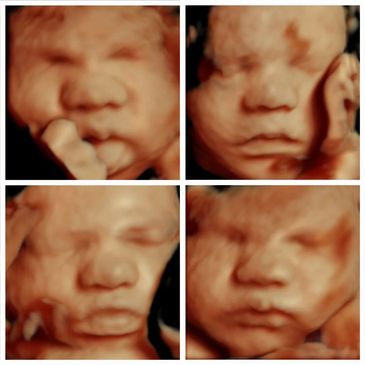 25-35 weeks 3d/4d ultrasound HD