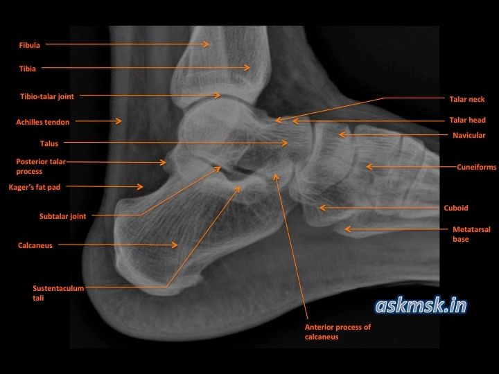 ankle xray anatomy