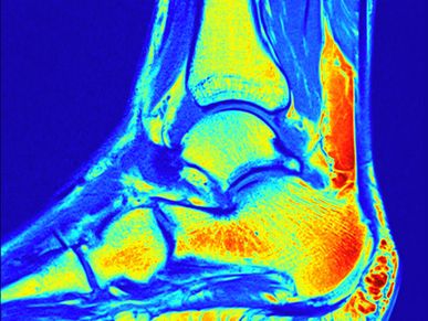 Ankle MRI anatomy