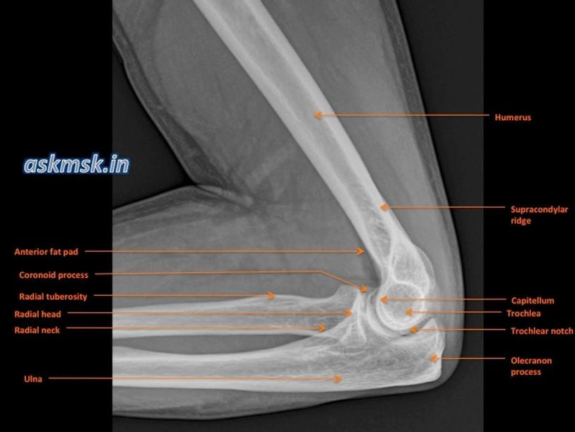 Elbow Xray Anatomy