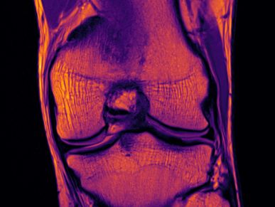 Knee MRI anatomy