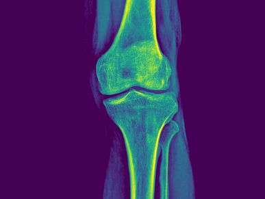 Knee Xray anatomy