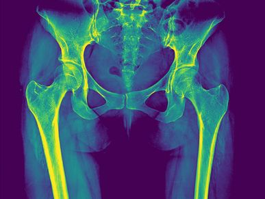 Pelvis with both hips Xray anatomy