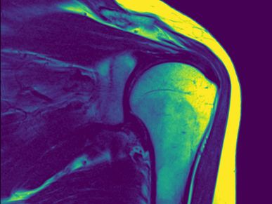 Shoulder MRI anatomy