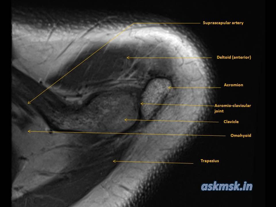 shoulder joint anatomy mri