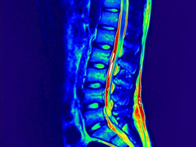 Spine MRI anatomy