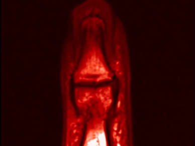 Thumb MRI anatomy