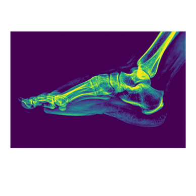 Ankle and Foot Xray anatomy