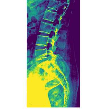 Cervical dorsal and lumbar spine Xray anatomy
