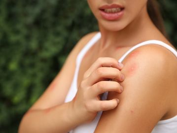 Close up shot of a woman scratching her body