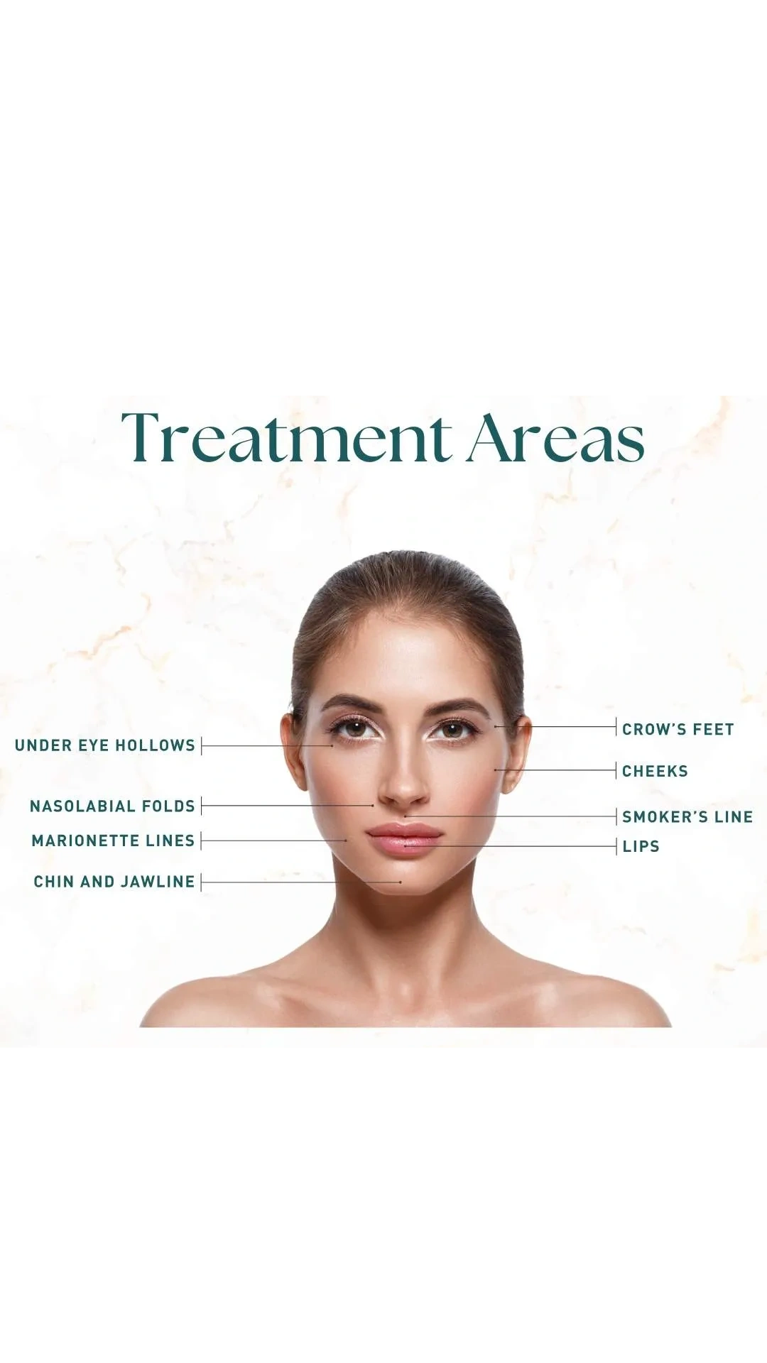 Ez Gel Treatment Areas