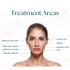 Ez Gel Treatment Areas