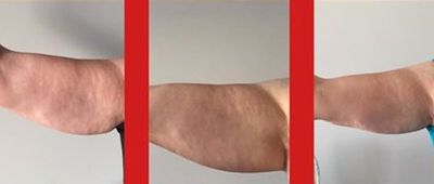 three images of arm of a person 