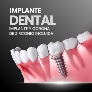 Dental implant with included zirconia crown shown in a gum model.