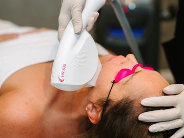 Photo Rejuvenation Facial - IPL - Laser - St Catharines Elite Spa - SharpLight Laser - Sugar & Spice