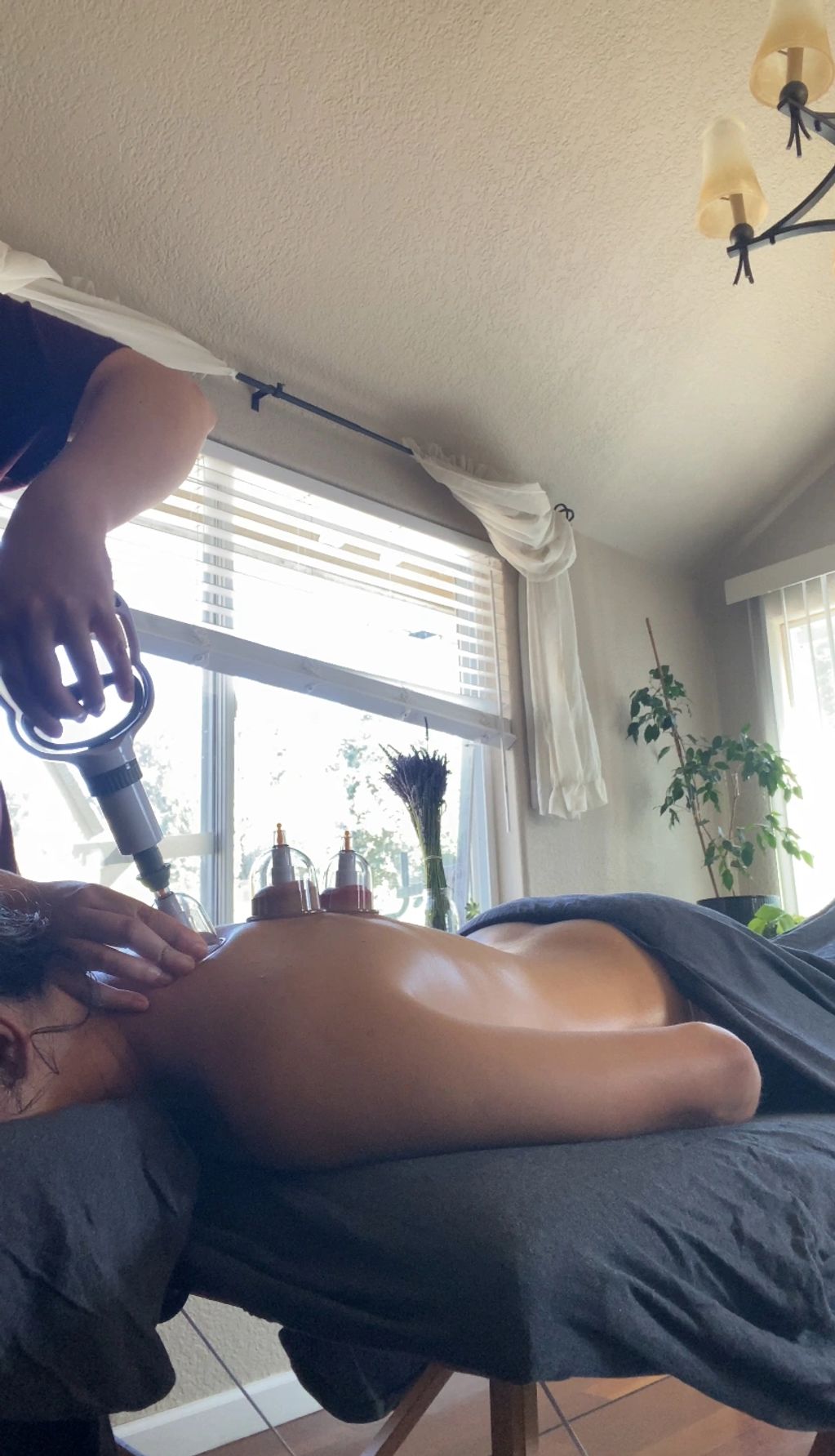 Cupping