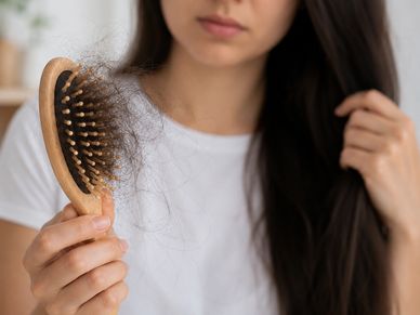 Mujer mostrando cabello caído en un cepillo.