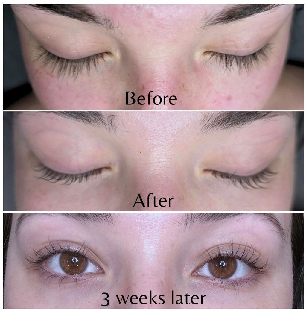 Eyelash growth progression over three weeks.