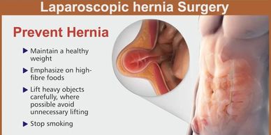 Hernia Surgery