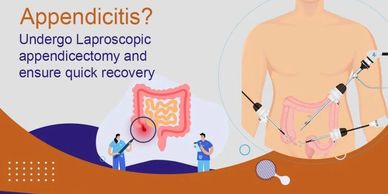 Appendix, Appendicitis, Appendicectomy, Laproscopy