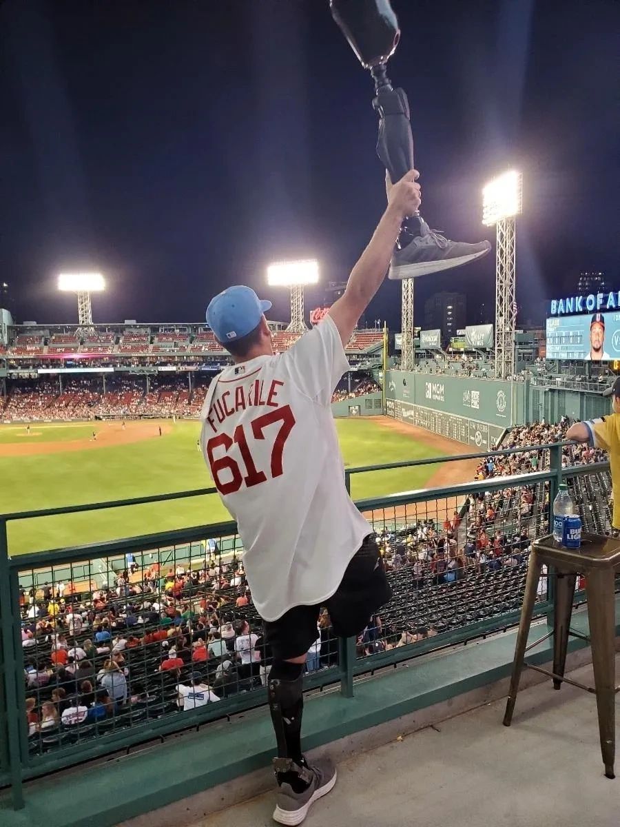 Man at baseball game holding up a prosthetic leg.