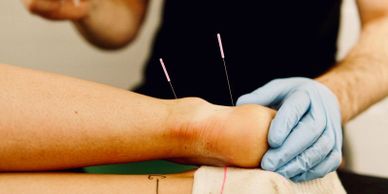 dry needle to ankle joint