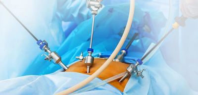 Laparoscopic procedure 