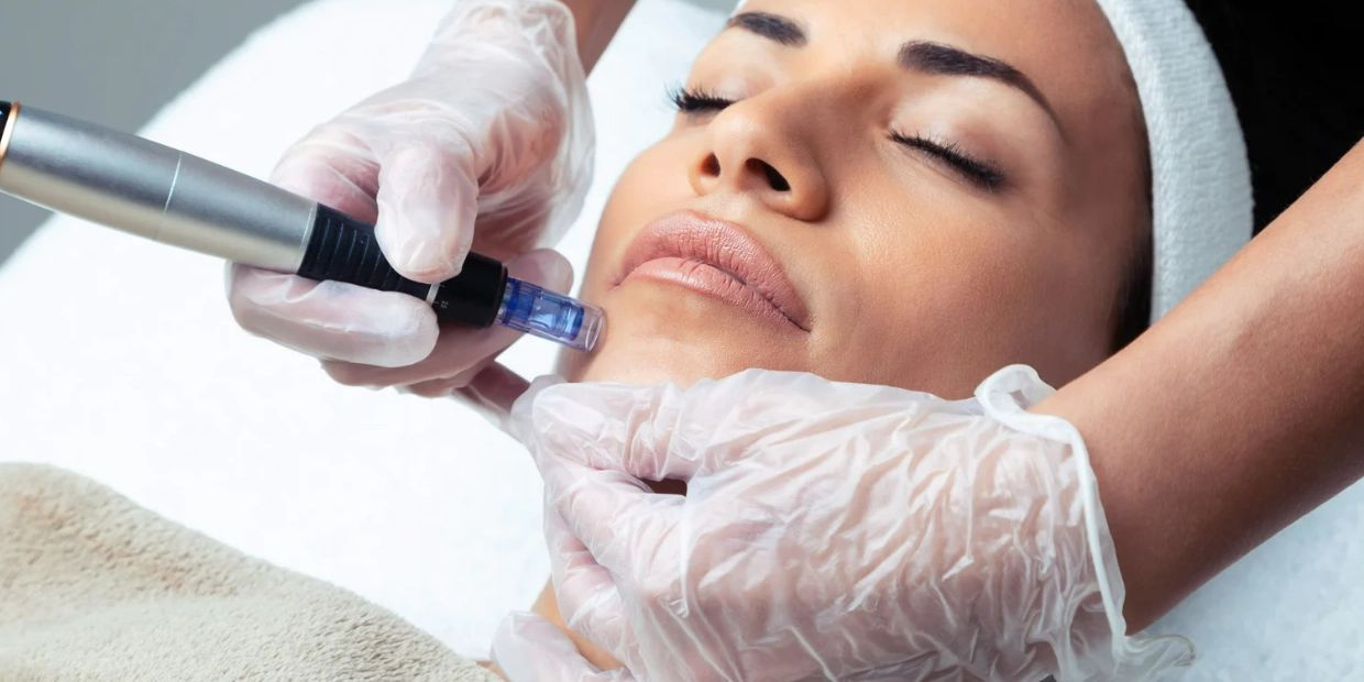 Derma 2.0, Medical grade treatment for the face, including micro needling and mesotherapy