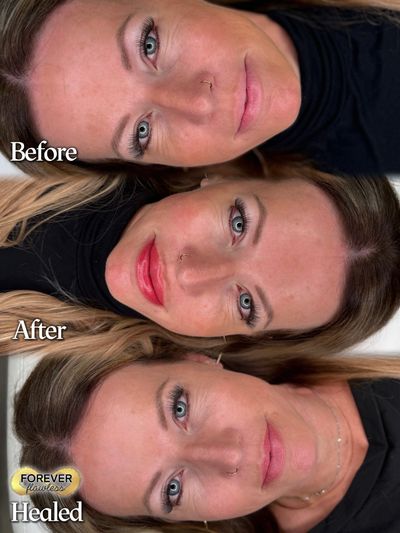 Before After Healed Lip Blush Barrie