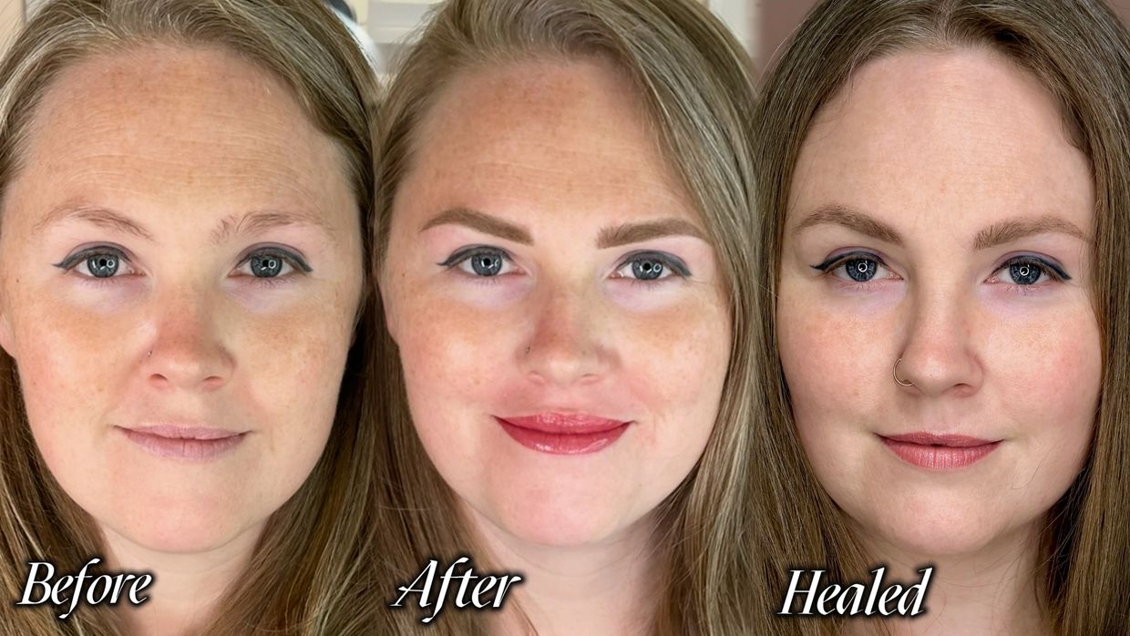 Healed Brows & Lips by Forever Flawless in Barrie