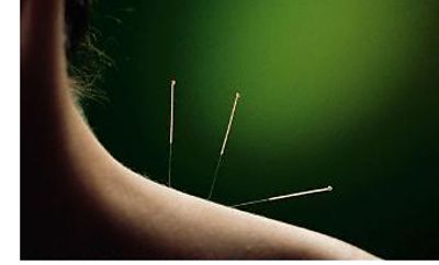 #acupuncture#acupuncturist 