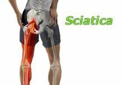 #sciatic#stiffness 