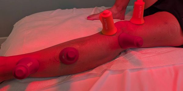 Leg with suction cups applied for therapeutic cupping treatment under red light.