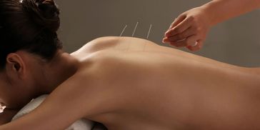 Person receiving acupuncture treatment on their back with needles inserted.