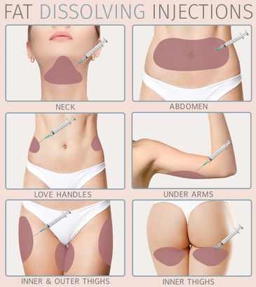 treatment locations for PCDC/lipolysis treatments/fat dissolving 