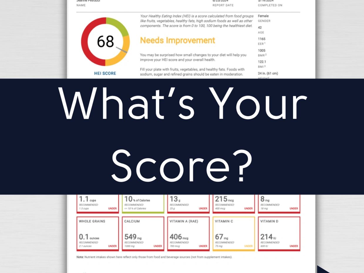 What is your score poster 