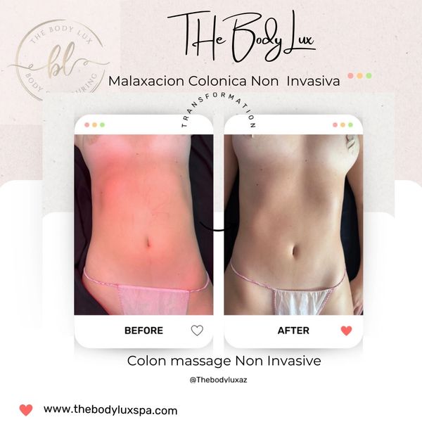 Non-Surgical Body Contouring Options at LUX Med Spa