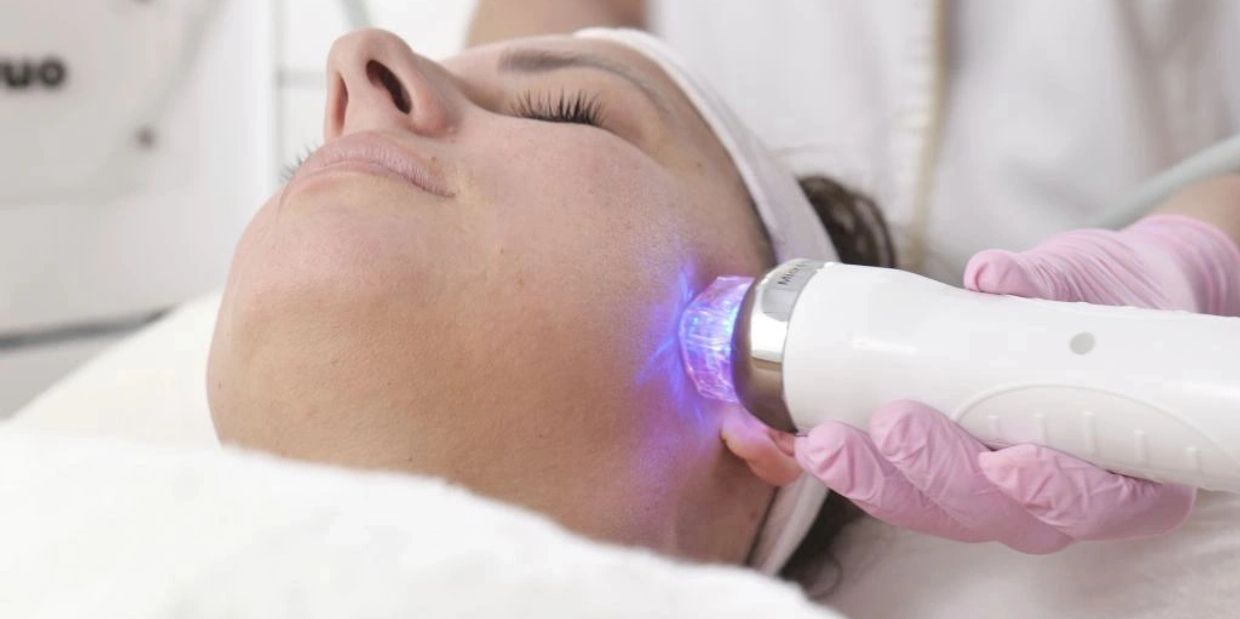 Rf Microneedling 