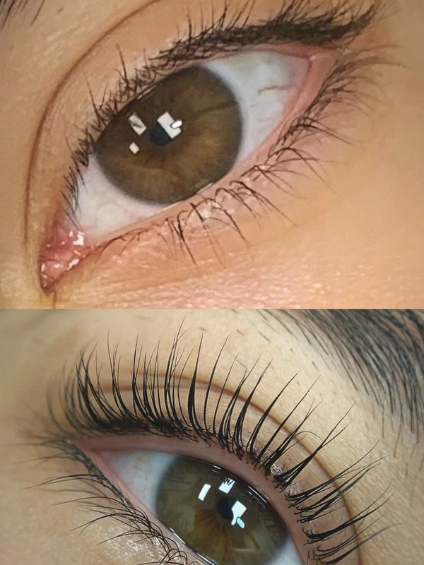Before and After