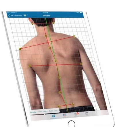 Tablet screen showing posture analysis of a man's back with lines and markers.