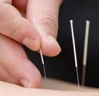 Medical Acupuncture