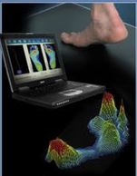 Computerized Gait Analysis