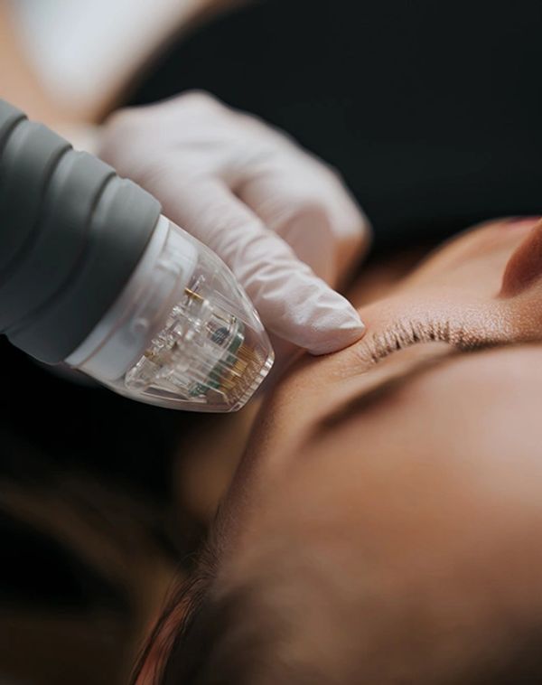 Close-up of a facial treatment using a high-tech device.