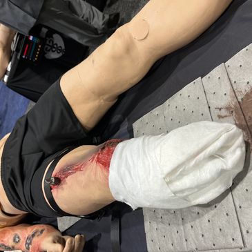 Leg amputation with medical dressing and blood visible on the stump.