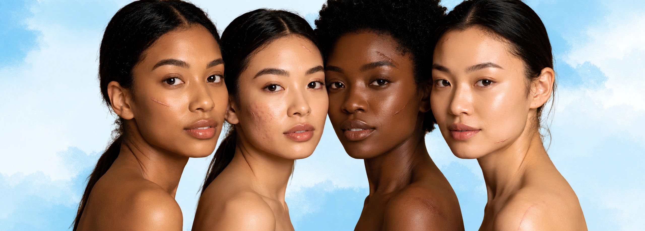 Diverse women with scars showing natural beauty.