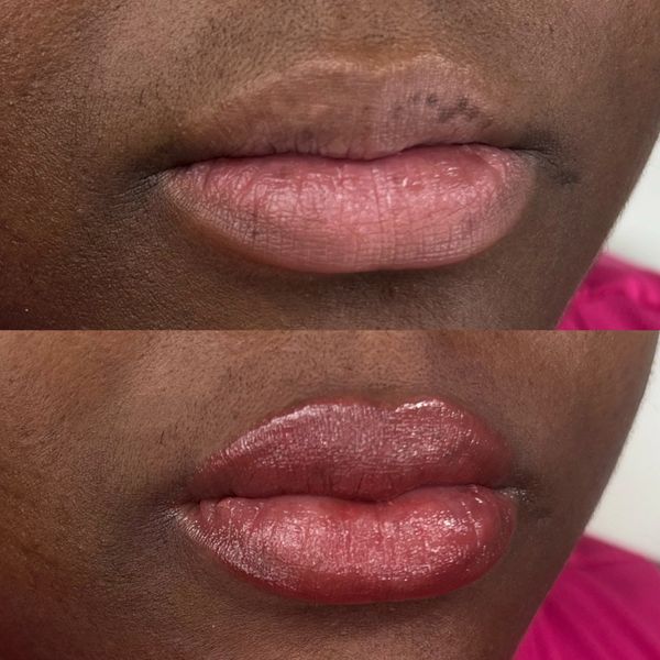 Lip blushing treatment