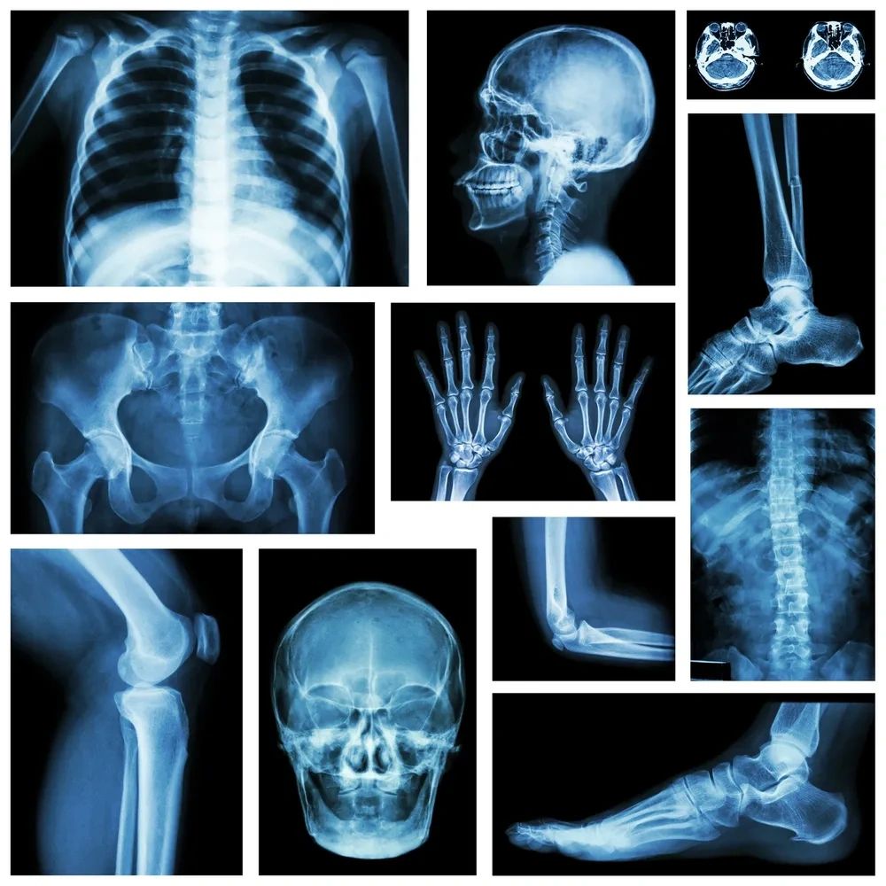 Radiology