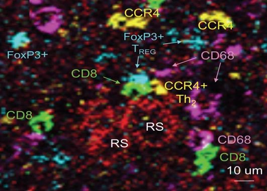 Imaging Mass Cytometry / CyTOF Tissue Imaging | SironaDx