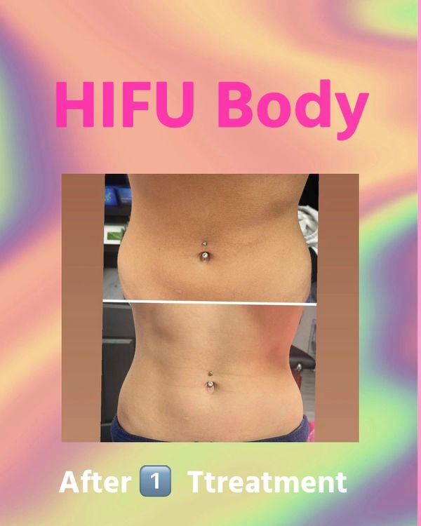 body
