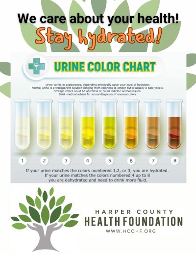 Urine color chart showing hydration levels and health advice.